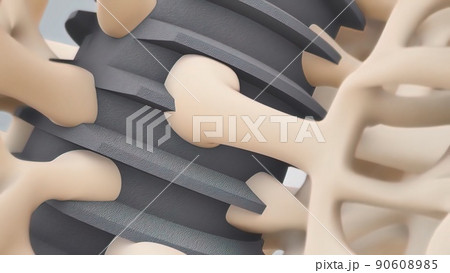 Compatibility of the implant to the gingiva Compatibility of the implant to the gingiva 90608985