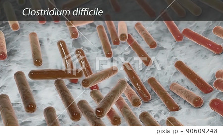 Clostridium difficile is a type of bacteria that causes colitis, a severe inflammation of the colon. 90609248