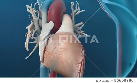 The term angioplasty means using a balloon to stretch open a narrowed The term angioplasty means using a balloon to stretch open a narrowed 90609396