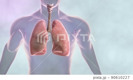 Early stage cancer and advanced stages of cancer. 90610227