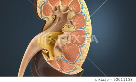 Kidney Stone Treatment. Lithotripsy. Kidney Stone Treatment. Lithotripsy. 90611158