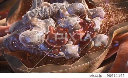 Kidney Stone Treatment. Lithotripsy. Kidney Stone Treatment. Lithotripsy. 90611165