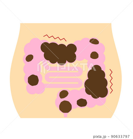 便秘のイメージ。不健康な腸内に溜まったウンチ。 90633797