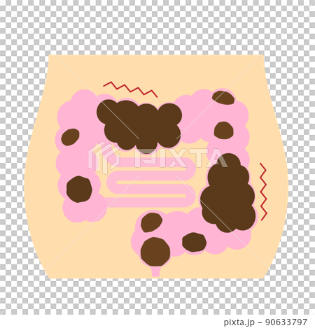 便秘のイメージ。不健康な腸内に溜まったウンチ。 90633797