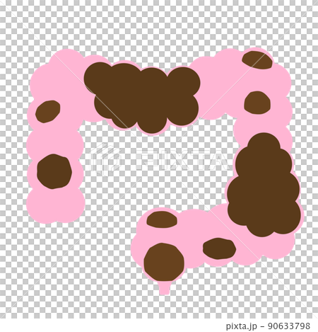 便秘のイメージ。不健康な腸内に溜まったウンチ。 90633798