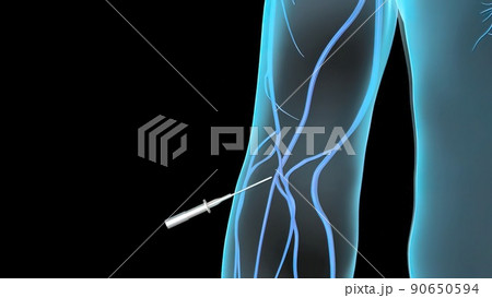 Aspiration venous blood from the leg into the body 90650594