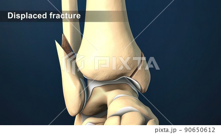 The fibula helps stabilize and support your leg, body, ankle, and leg muscles 90650612