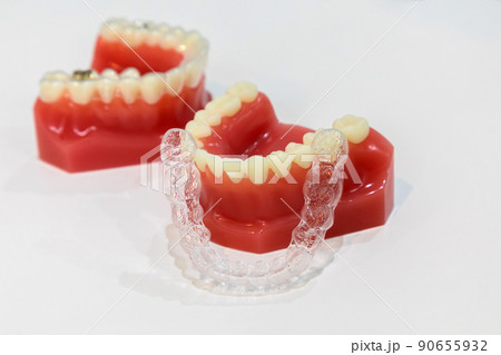 マウスピース矯正 歯科イメージ マウスピース矯正 歯科イメージ 90655932