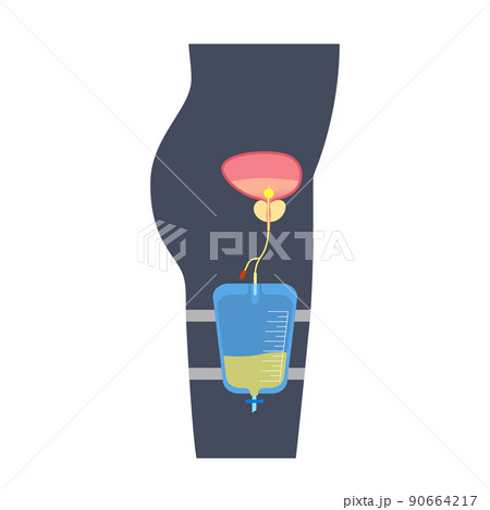 Urinary drainage bag Urinary drainage bag 90664217