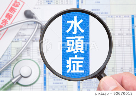 水頭症 水頭症 90670015