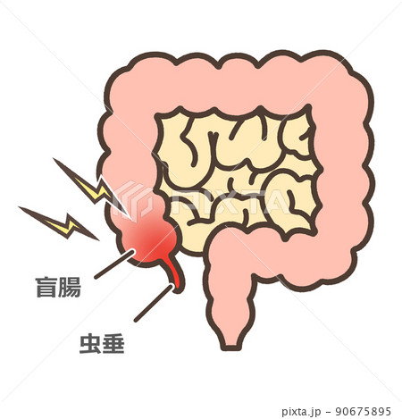 盲腸の図解イラスト 90675895