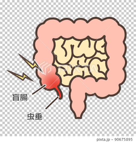 盲腸の図解イラスト 90675895
