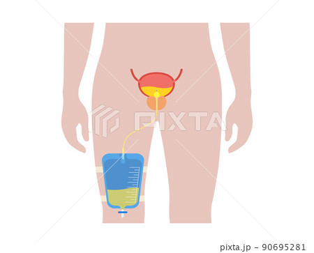 Urinary drainage bag 90695281