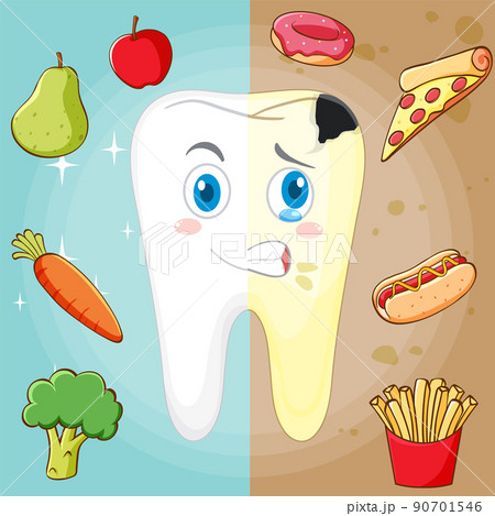 Poster of healthy tooth and tooth decay Poster of healthy tooth and tooth decay 90701546