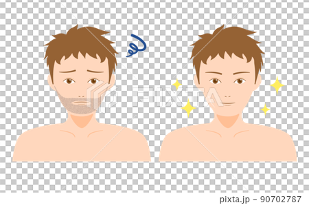 ヒゲの脱毛 男性 ビフォーアフター 90702787