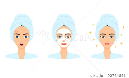 Young woman with acne. Treatment, before and after skincare. Face mask, beauty concept, vector illustration 90764841