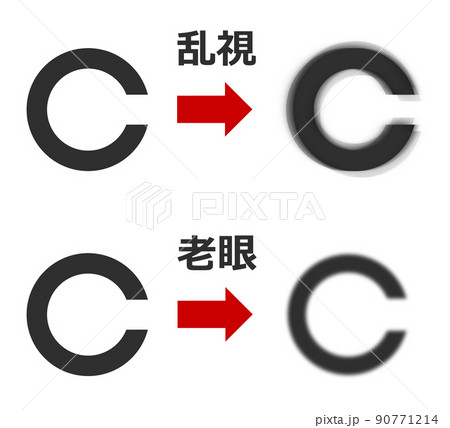 健康診断の視力検査で異常が発見されるイラスト 90771214