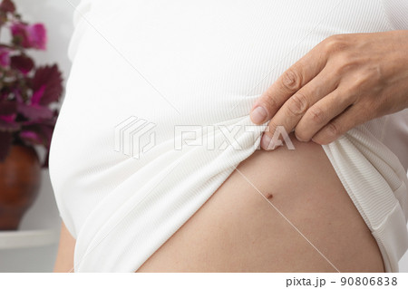 Woman showing birthmark on body Woman showing birthmark on body 90806838