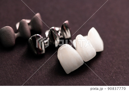 Teeth implant and crown installation process parts isolated on a black background. Medically accurate 3D model.  90837770