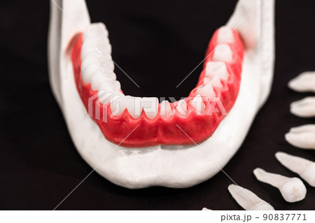 Teeth implant and crown installation process parts isolated on a black background. Medically accurate 3D model.  90837771
