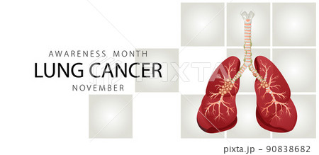 Banner informing about lung cancer. Design template for websites, magazines. Vector illustration cartoon style. 90838682