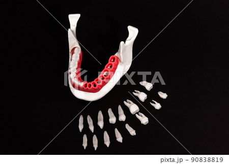 Teeth implant and crown installation process parts isolated on a black background. Medically accurate 3D model. Teeth implant and crown installation process parts isolated on a black background. Medically accurate 3D model. 90838819