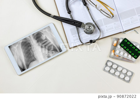 The doctor checks the correctness work of the pacemaker on the digital tablet view x-ray 90872022