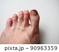 足を踏まれて割れて出血した親指の爪 90963359