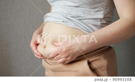 Woman touches fat on flabby sagging belly after pregnancy 90993508