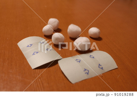 出べその治療 91019288