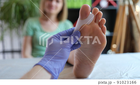 Orthopedist examines leg with hallux valgus deformity of big toe 91023166