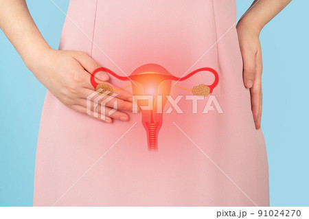 Woman suffering from pelvic pain with uterus and ovaries anatomy. Cause of pain inclued dysmenorrhea, edometriosis, PCOS, PMS, STDs, gynecologic cancer. Reproductive system and woman health problems. 91024270