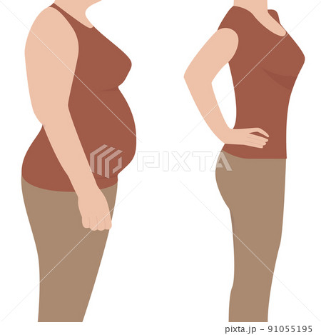 Before and after. Overweight woman and a woman with a slim waist. Flat. Vector. 91055195