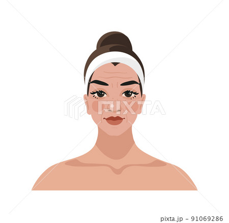 Middle aged woman with age changes flat cartoon icon isolated on white. Female portrait for advertising cosmetics, beauty treatments, beauty injections. Vector illustration of a beauty salon. Middle aged woman with age changes flat cartoon icon isolated on white. Female portrait for advertising cosmetics, beauty treatments, beauty injections. Vector illustration of a beauty salon. 91069286