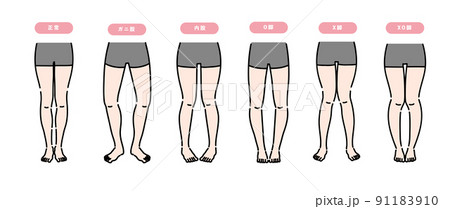 矯正が必要な女性の脚のセット 91183910