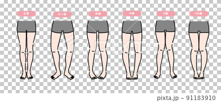 A set of female legs that need orthodontics - Stock Illustration ...