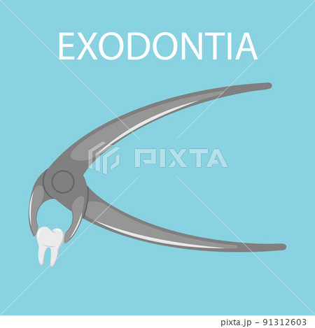 Dental tooth extraction. Exodontia. The tooth in the dental forceps. A white clean tooth is clamped between the forceps. Professional dental instrument. Isolated flat vector illustration. Dental tooth extraction. Exodontia. The tooth in the dental forceps. A white clean tooth is clamped between the forceps. Professional dental instrument. Isolated flat vector illustration. 91312603