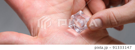 A man's hand is rubbing calluses with an ice cube 91333147