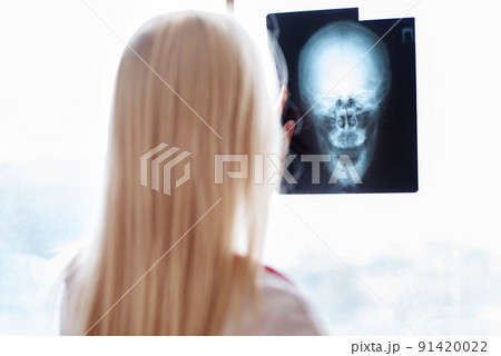 Woman Doctor Looking at X-Ray Radiography. Woman Doctor Looking at X-Ray Radiography. 91420022
