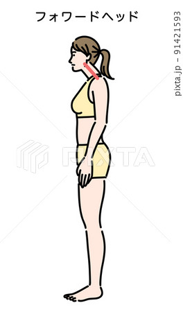 フォワードヘッドの姿勢になっている若い女性 91421593