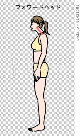 フォワードヘッドの姿勢になっている若い女性 91421593