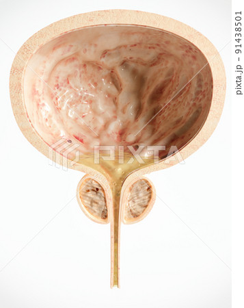 Close-up of a healthy prostate - 3D rendering 91438501