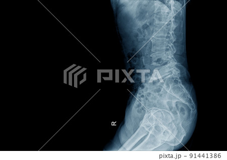 lateral view of human structure lateral view of human structure 91441386