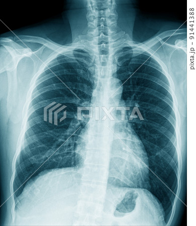 洋書【解剖学・骨格がわかる】レントゲン遊び AMAZING X-RAYS 人体