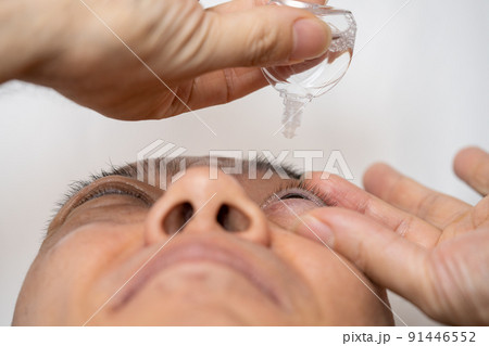 目薬をさす男性 目薬をさす男性 91446552