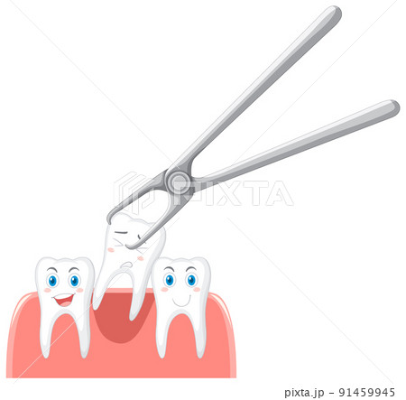 Cartoon teeth extraction on white backgroundのイラスト素材 [91459945] - PIXTA