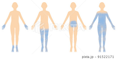 人物_4冷え性タイプ別 人物_4冷え性タイプ別 91522171