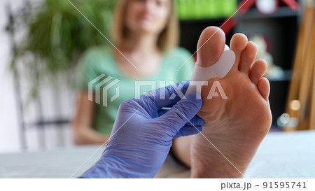 Doctor orthopedist examining leg with hallux valgus deformity of first toe Doctor orthopedist examining leg with hallux valgus deformity of first toe 91595741