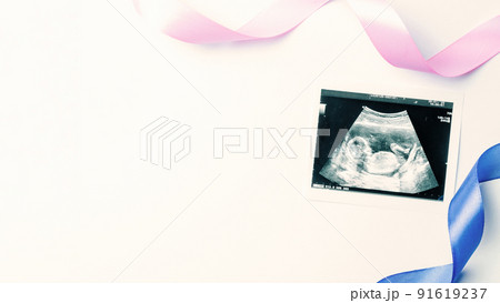 Ultrasound photo pregnancy baby. Blue, pink ribbon with ultrasound pregnancy picture on white background. Concept maternity, pregnancy, childbirth. Ultrasound photo pregnancy baby. Blue, pink ribbon with ultrasound pregnancy picture on white background. Concept maternity, pregnancy, childbirth. 91619237