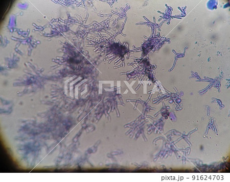 窓際で採取したカビは植物病原菌 窓際で採取したカビは植物病原菌 91624703